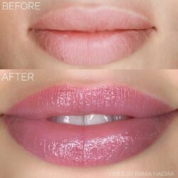 Lip colour treatment